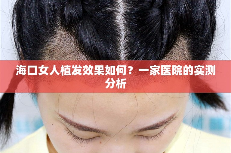 海口女人植发效果如何？一家医院的实测分析