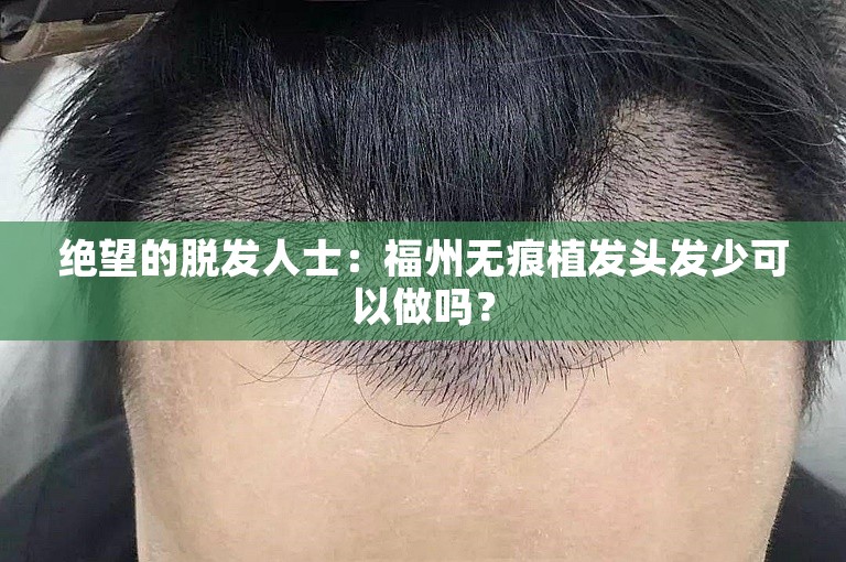 绝望的脱发人士：福州无痕植发头发少可以做吗？