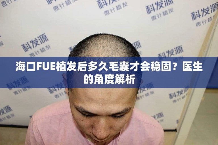 海口FUE植发后多久毛囊才会稳固？医生的角度解析