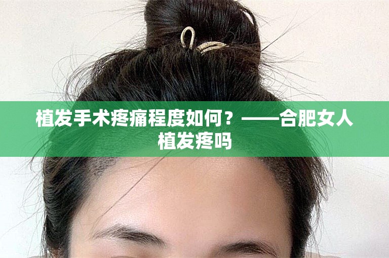 植发手术疼痛程度如何？——合肥女人植发疼吗