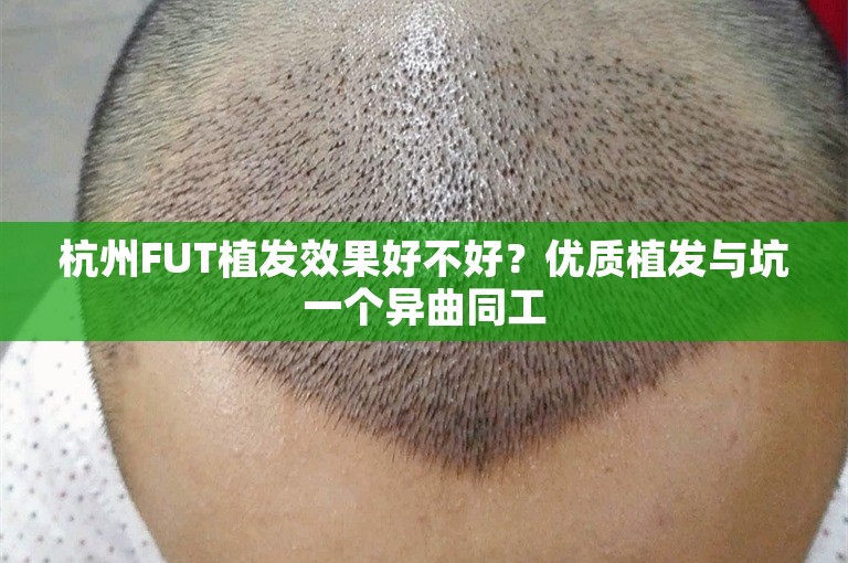 杭州FUT植发效果好不好？优质植发与坑一个异曲同工