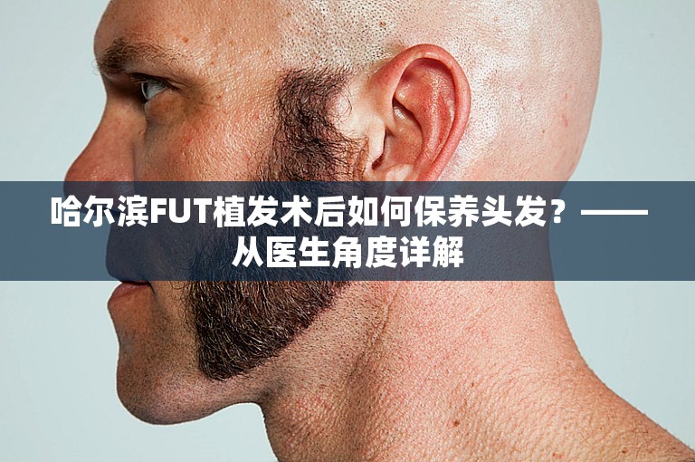 哈尔滨FUT植发术后如何保养头发？——从医生角度详解