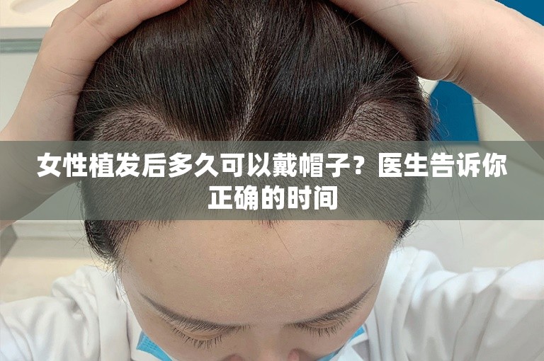 女性植发后多久可以戴帽子？医生告诉你正确的时间