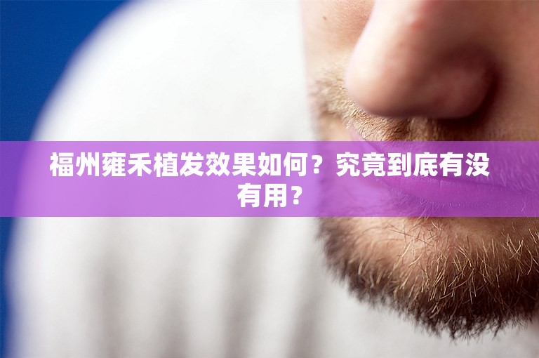 福州雍禾植发效果如何？究竟到底有没有用？