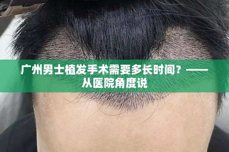 广州男士植发手术需要多长时间？——从医院角度说