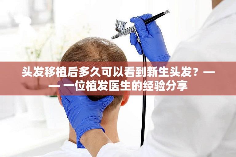 头发移植后多久可以看到新生头发？—— 一位植发医生的经验分享