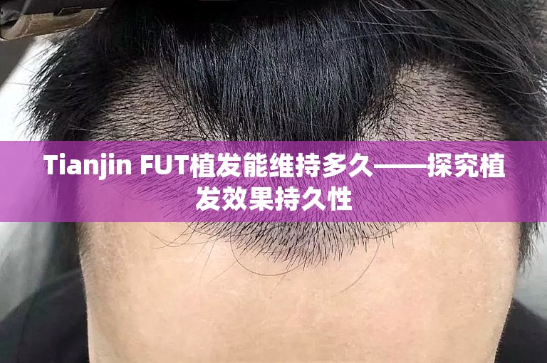 Tianjin FUT植发能维持多久——探究植发效果持久性