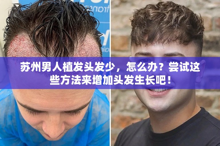 苏州男人植发头发少，怎么办？尝试这些方法来增加头发生长吧！