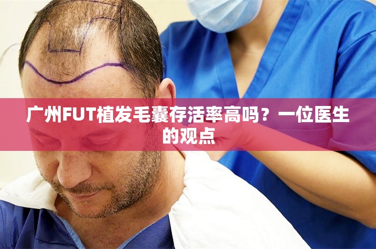 广州FUT植发毛囊存活率高吗？一位医生的观点