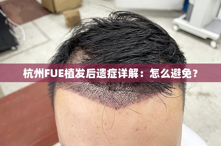 杭州FUE植发后遗症详解：怎么避免？