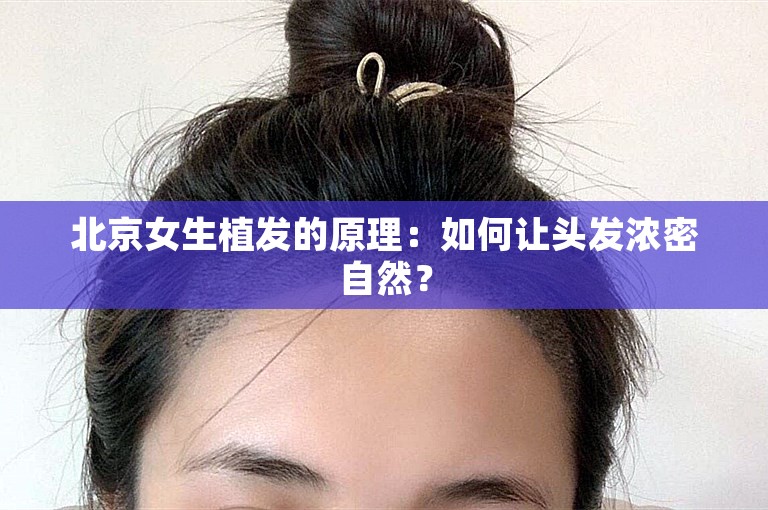 北京女生植发的原理：如何让头发浓密自然？