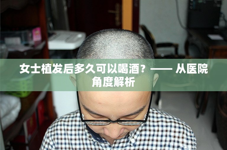 女士植发后多久可以喝酒？—— 从医院角度解析