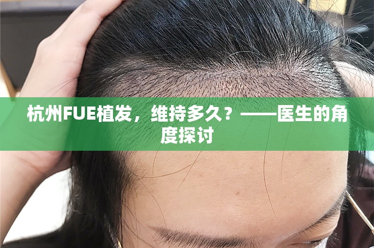 杭州FUE植发，维持多久？——医生的角度探讨