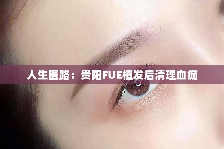 人生医路：贵阳FUE植发后清理血痂