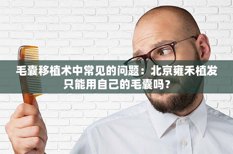 毛囊移植术中常见的问题：北京雍禾植发只能用自己的毛囊吗？