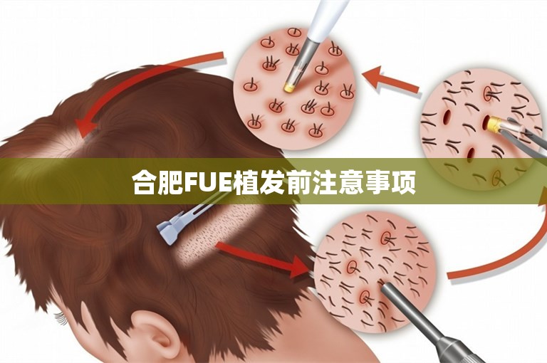 合肥FUE植发前注意事项