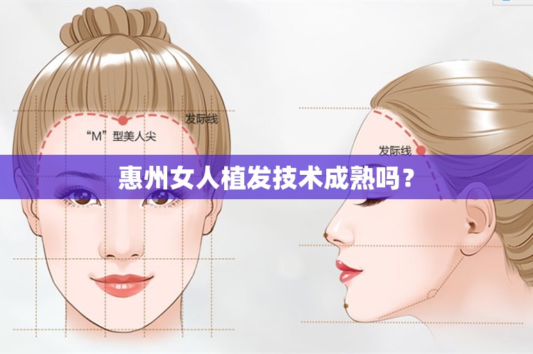 惠州女人植发技术成熟吗？