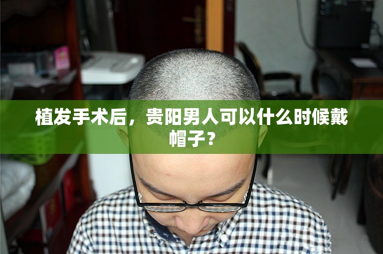 植发手术后，贵阳男人可以什么时候戴帽子？