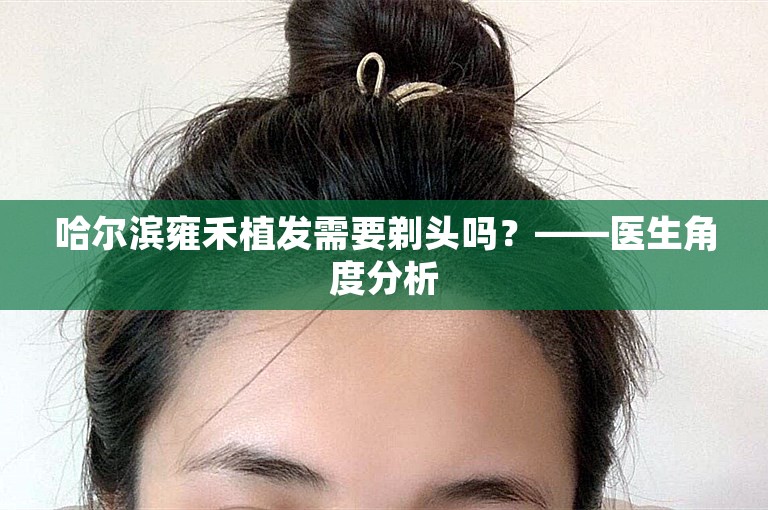 哈尔滨雍禾植发需要剃头吗？——医生角度分析