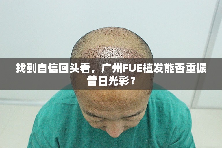 找到自信回头看，广州FUE植发能否重振昔日光彩？