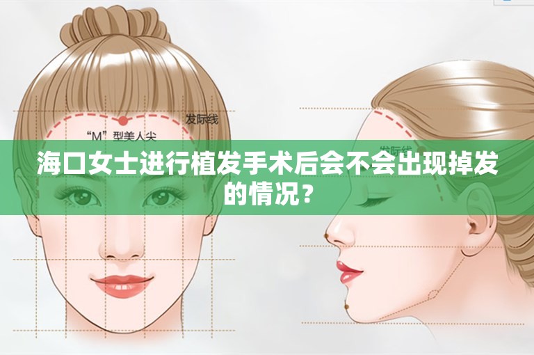 海口女士进行植发手术后会不会出现掉发的情况？