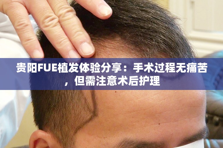 贵阳FUE植发体验分享：手术过程无痛苦，但需注意术后护理