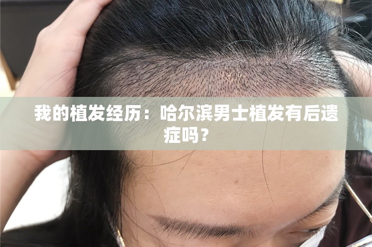 我的植发经历：哈尔滨男士植发有后遗症吗？