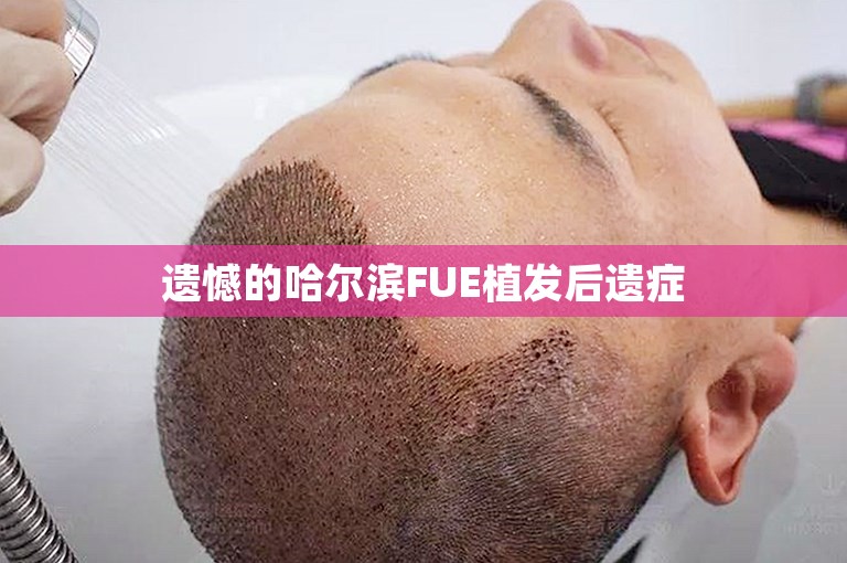 遗憾的哈尔滨FUE植发后遗症