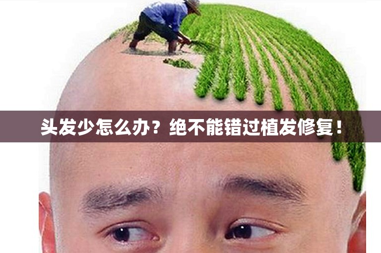 头发少怎么办？绝不能错过植发修复！