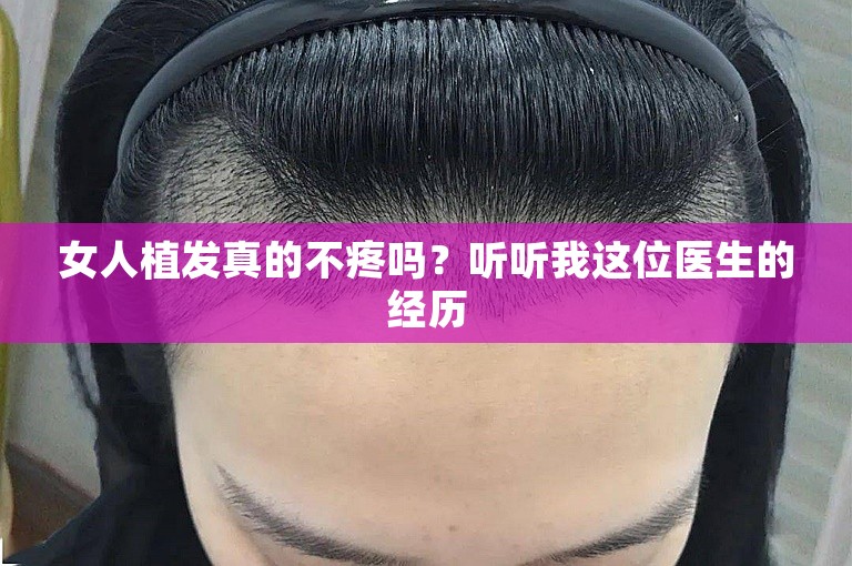 女人植发真的不疼吗？听听我这位医生的经历