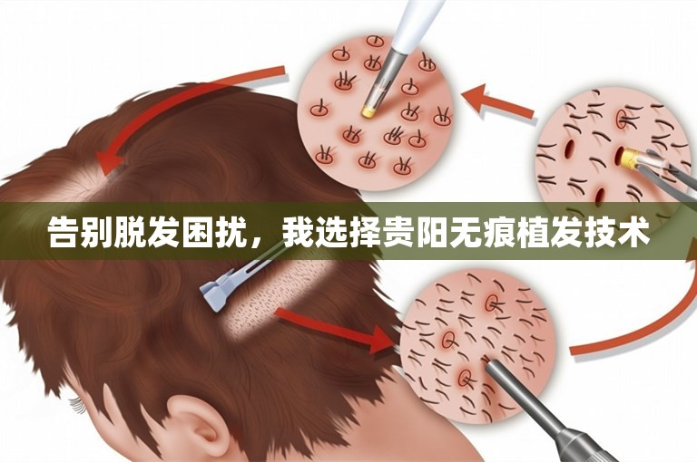 告别脱发困扰，我选择贵阳无痕植发技术