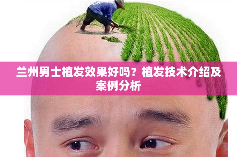 兰州男士植发效果好吗？植发技术介绍及案例分析