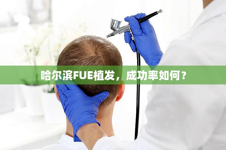 哈尔滨FUE植发，成功率如何？