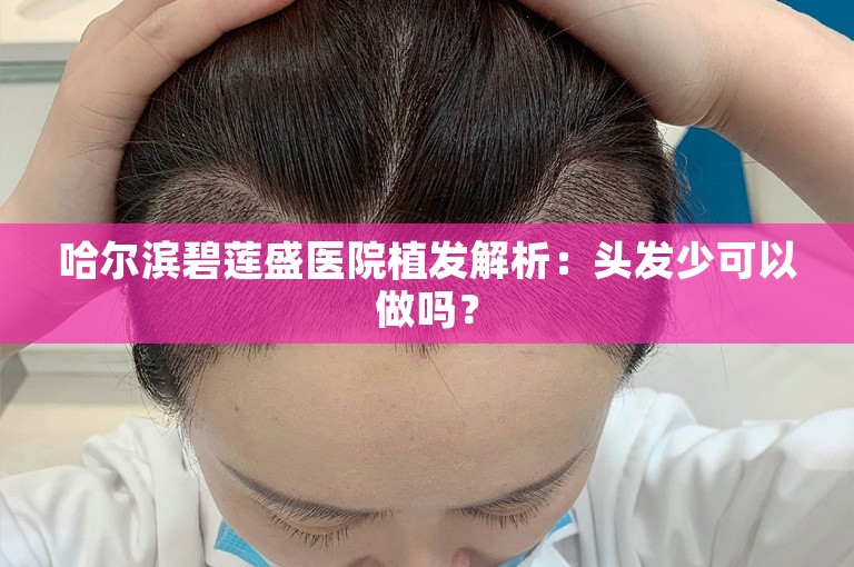 哈尔滨碧莲盛医院植发解析：头发少可以做吗？