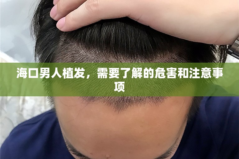 海口男人植发，需要了解的危害和注意事项