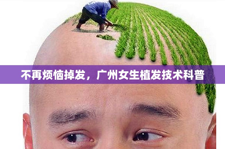 不再烦恼掉发，广州女生植发技术科普