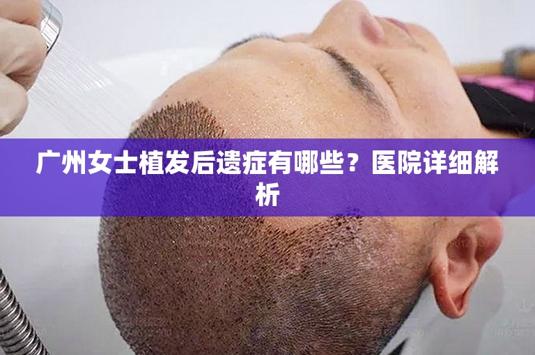 广州女士植发后遗症有哪些？医院详细解析