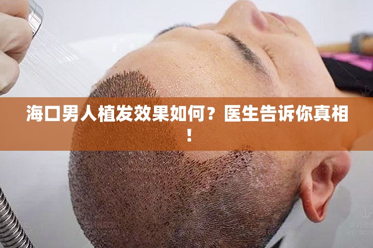 海口男人植发效果如何？医生告诉你真相！