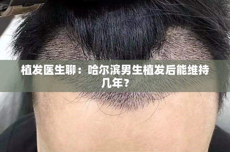 植发医生聊：哈尔滨男生植发后能维持几年？