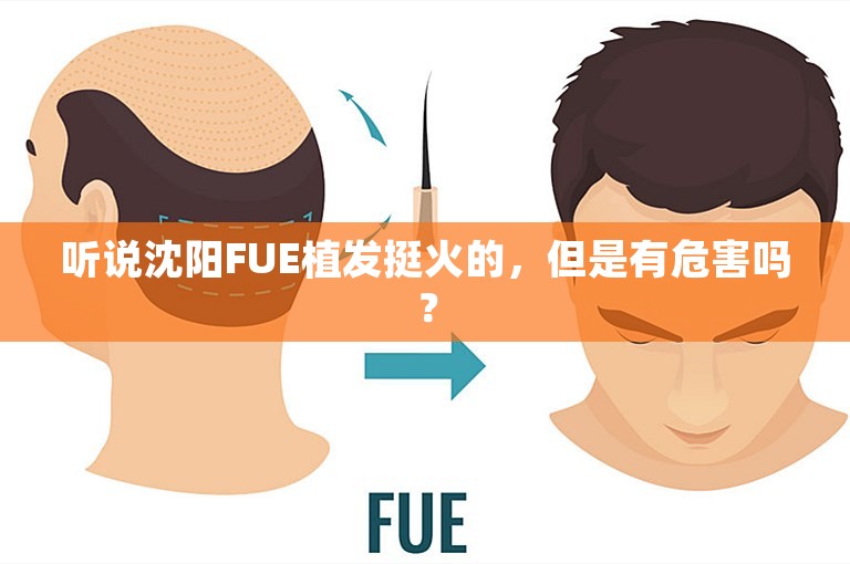 听说沈阳FUE植发挺火的，但是有危害吗？