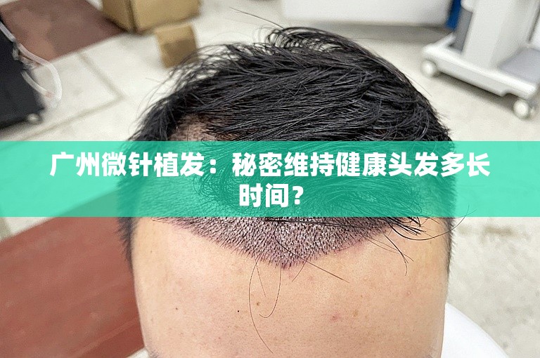 广州微针植发：秘密维持健康头发多长时间？