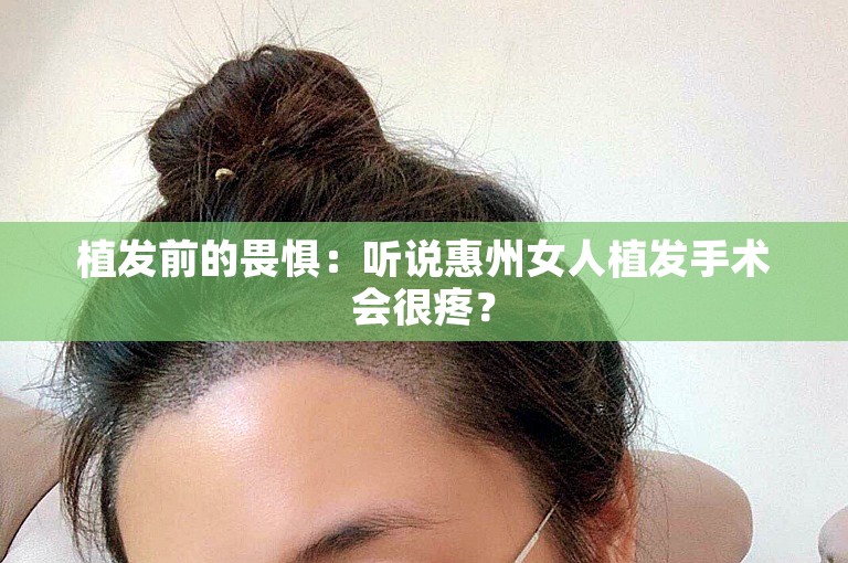 植发前的畏惧：听说惠州女人植发手术会很疼？