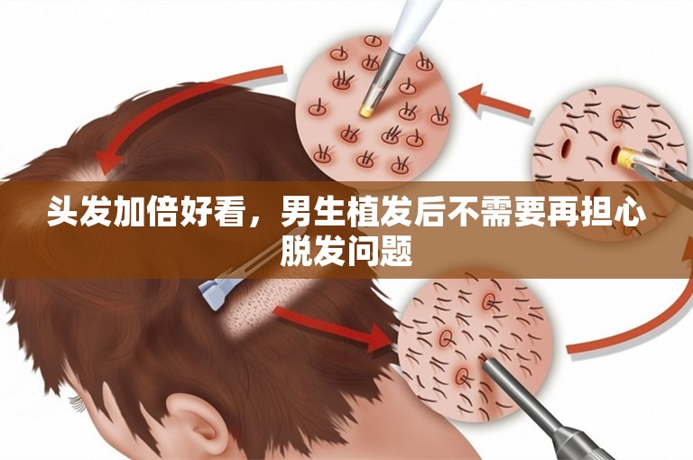 头发加倍好看，男生植发后不需要再担心脱发问题