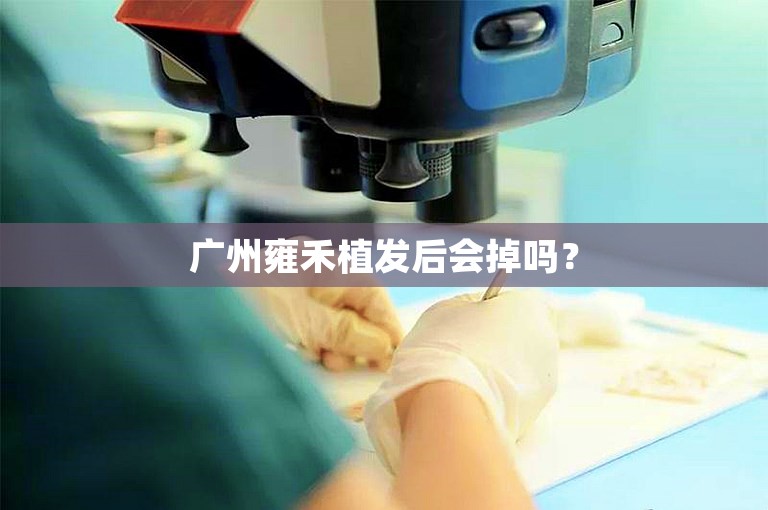 广州雍禾植发后会掉吗？