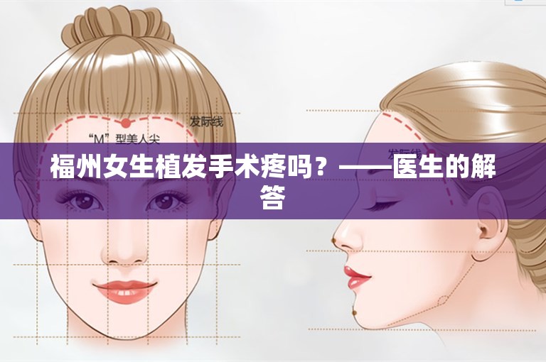 福州女生植发手术疼吗？——医生的解答