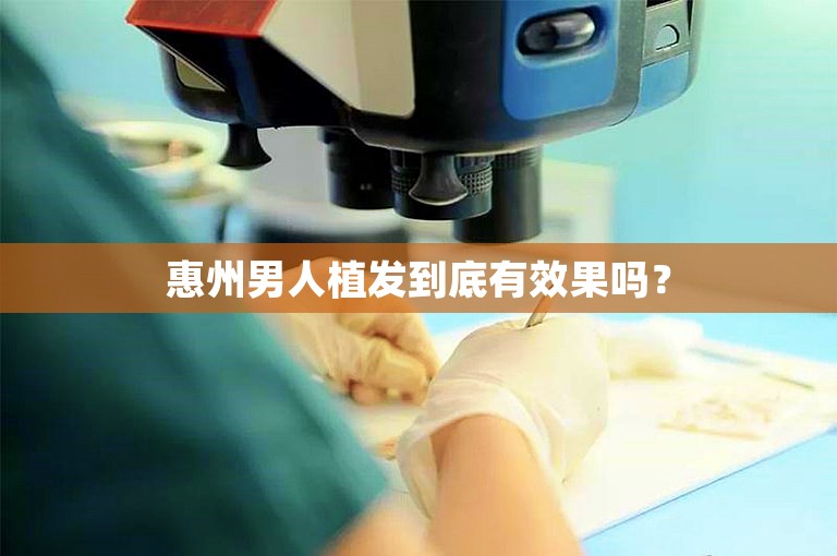 惠州男人植发到底有效果吗？