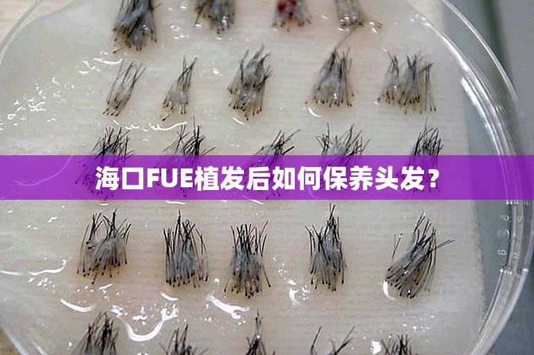 海口FUE植发后如何保养头发？