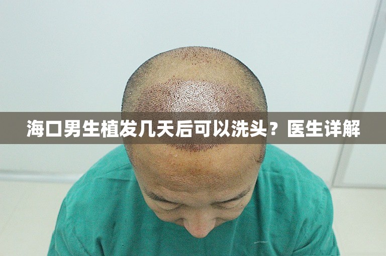 海口男生植发几天后可以洗头？医生详解