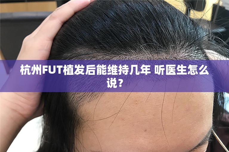 杭州FUT植发后能维持几年 听医生怎么说？