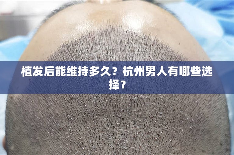 植发后能维持多久？杭州男人有哪些选择？